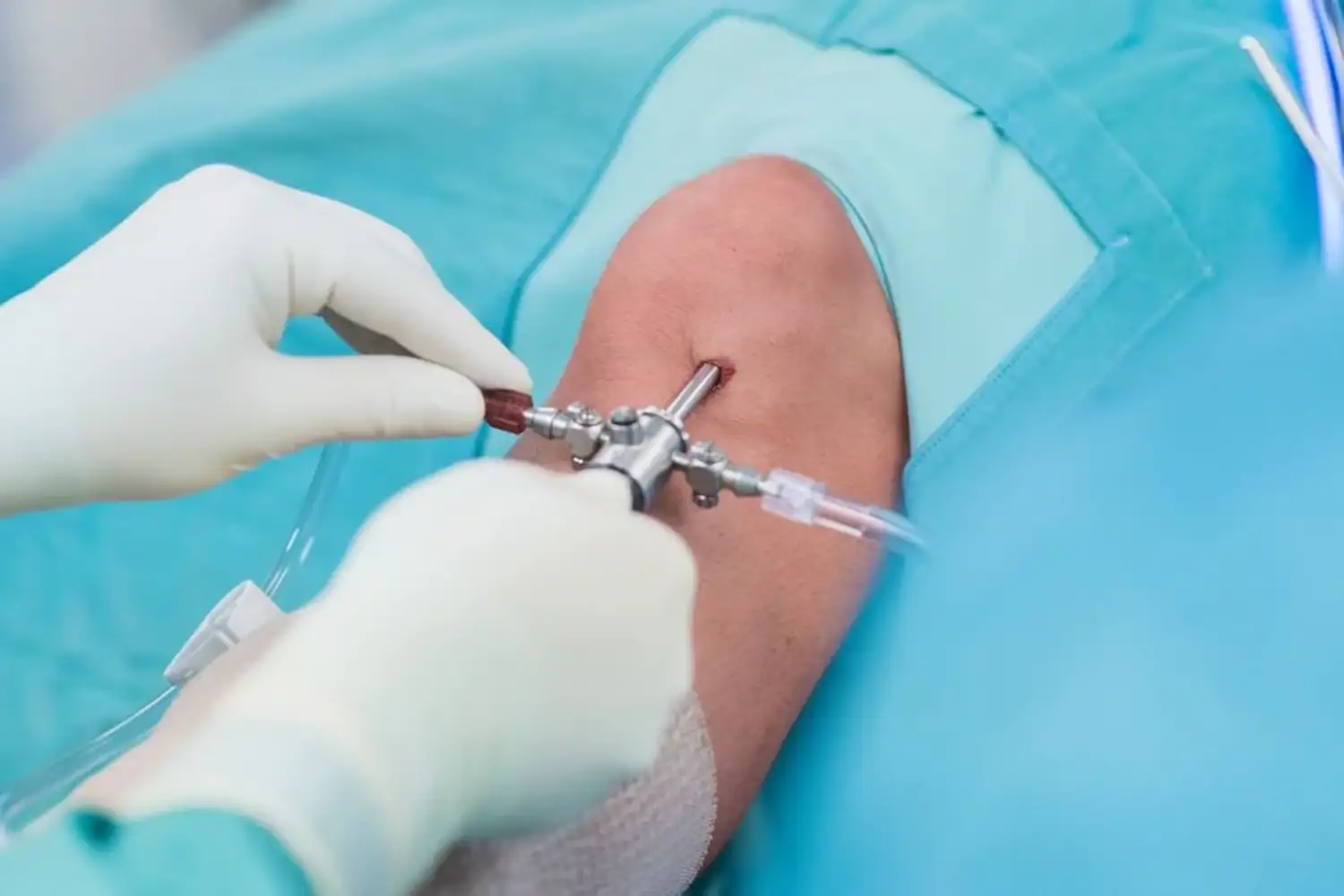 kreuzband operation wien bei dr. markus figl