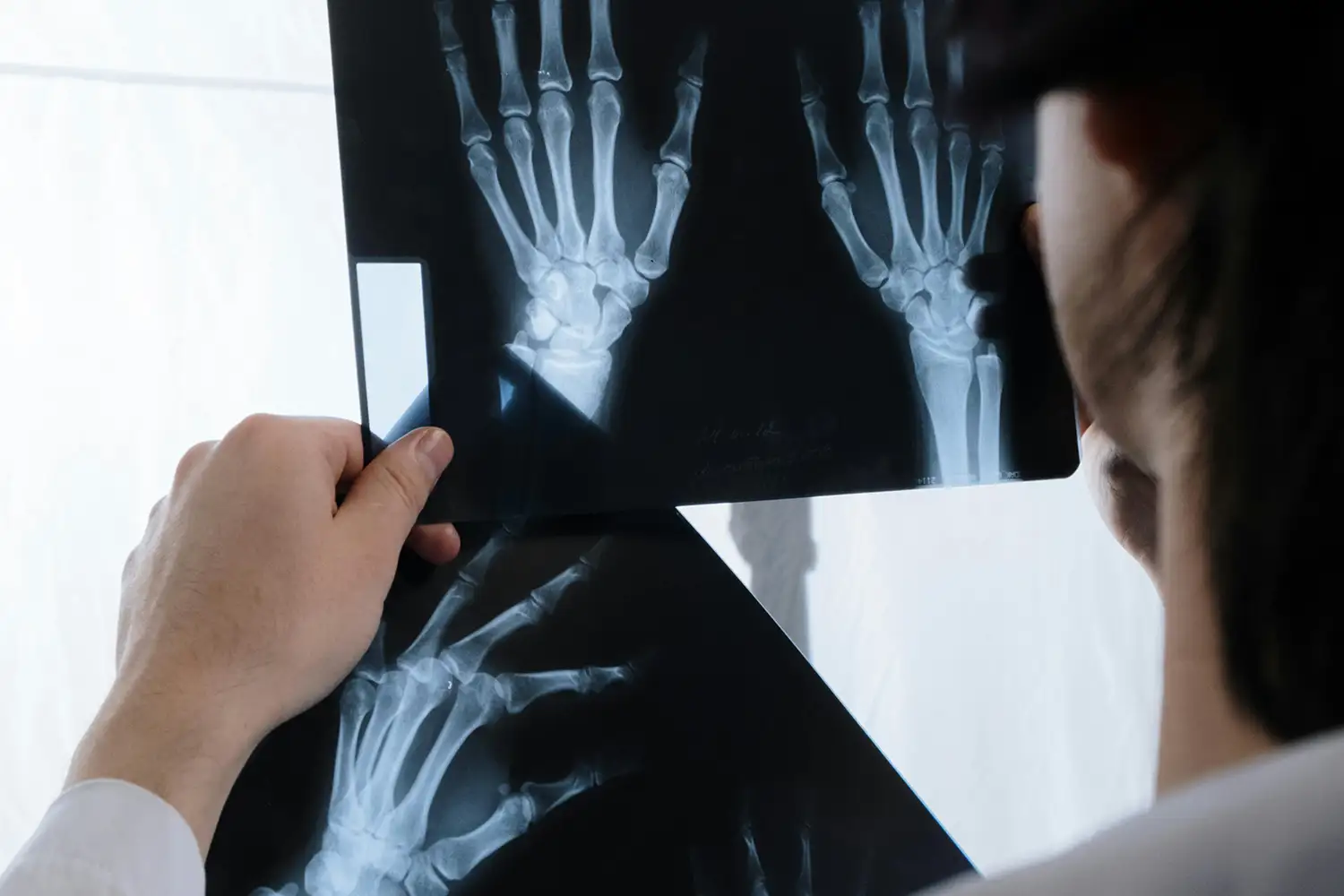 dr. markus figl bei der diagnose und ansicht von röntgenbilder von beiden händen eines patienten.